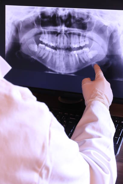 Best Emergency Root Canal Treatment in Gerber, CA
